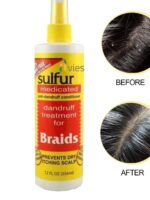 Sulfur 8 Medicated Dandruff Treatment