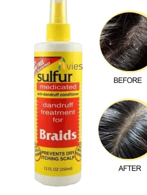 Sulfur 8 Medicated Dandruff Treatment
